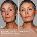 Base de Maquillaje de Cobertura Media Triclone Skin Tech